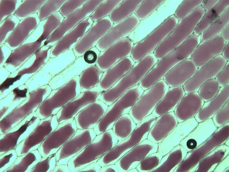 Plasmolyse