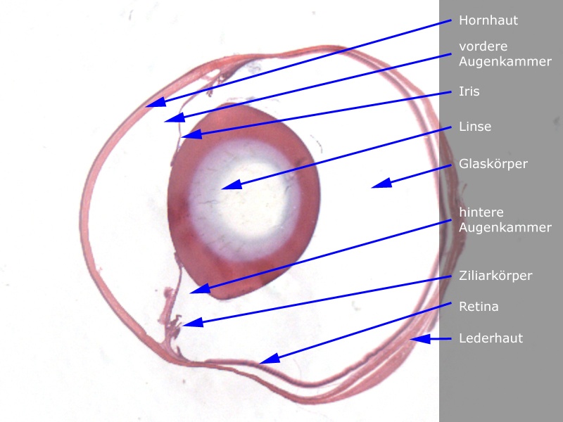 Auge gesamt