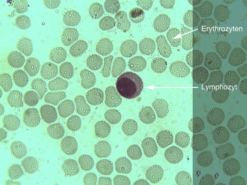 Lymphozyt