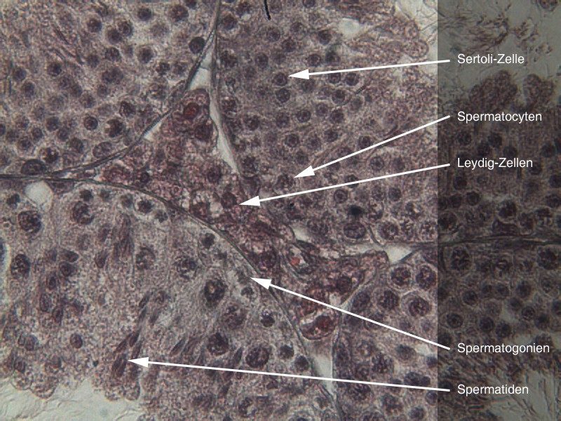 Leydig-Zellen 