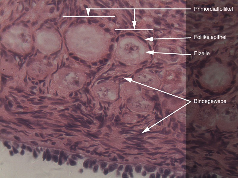 Primordialfollikel