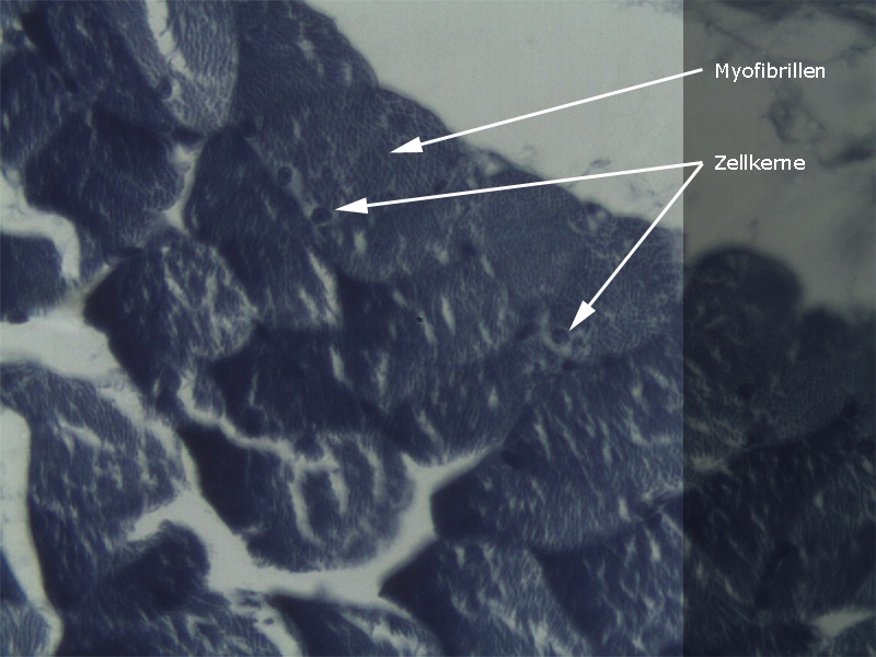 Myofibrillen