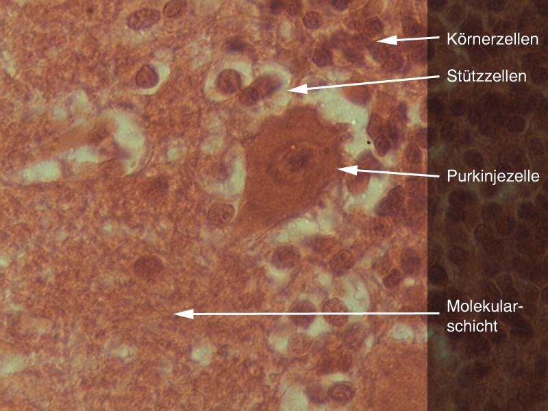 Purkinje-Zelle