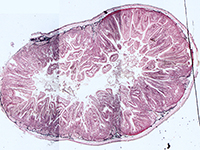 Duodenum