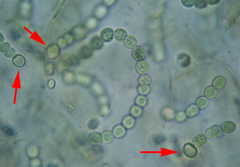 Nostoc commune