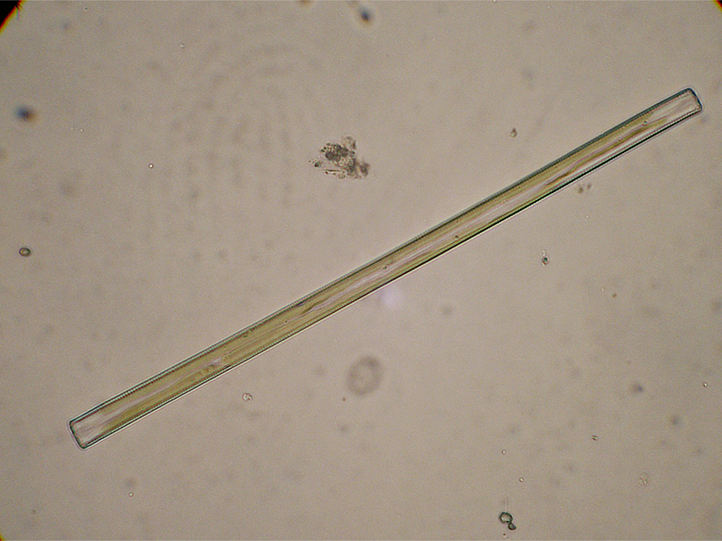 Fragilaria sp.