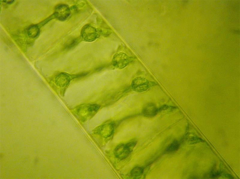 Spirogyra sp.