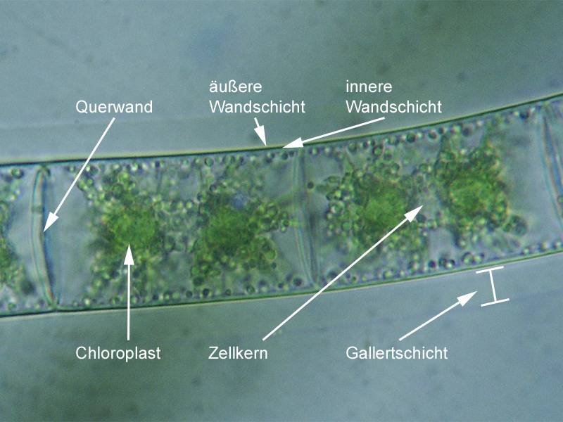 Zygnema sp.