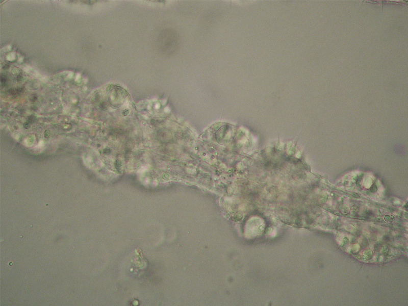 Hydra vulgaris