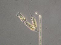 Dinobryon sp.